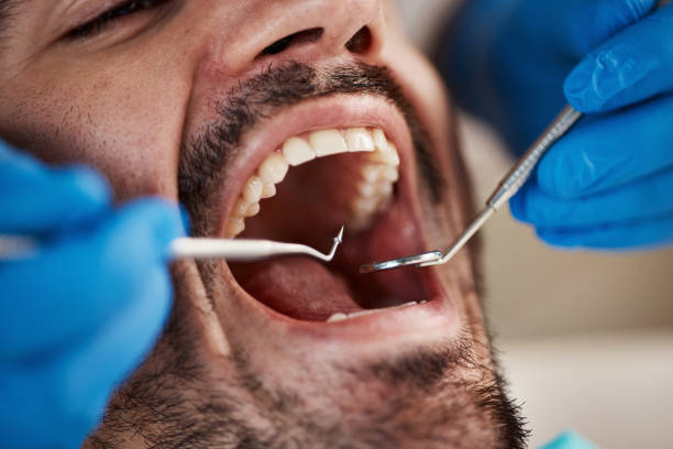 Best Teeth Whitening  in Corrigan, TX